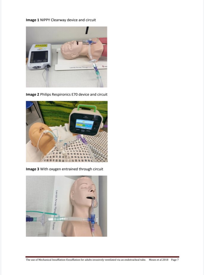 MI-E via ETT guidance available here:
dropbox.com/s/jauf0g4n3bng… 

Designed as a guide to aid practical application using best evidence and clinical knowledge.

Please share widely and happy to be used as original document or to develop own local guidelines

#coughassist #RespEd