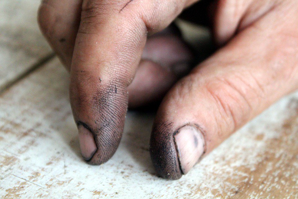 SwarfegaUK's tweet photo. Fingernails are just modified hairs. #HandFact https://t.co/NlkQrllFZ2