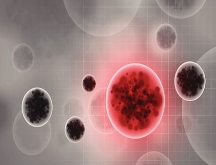 DrJMCos's tweet photo. ¿Debemos alarmarnos por la presencia de sangre en el semen?
https://t.co/n1RYBFcHES
#hemospermia #sangresemen #sangre #urologia https://t.co/z4ugyauZaH