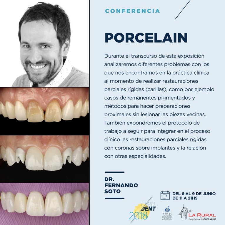 expodentBA's tweet photo. Avance // Conferencia

Dr. Fernando Soto
PORCELAIN

>> Sábado 09 de junio - 13 hs [SWR2] <<

> Inscribite! https://t.co/xghS6LRlAy <

Expodent 2018
La Rural
 #expodentba2018 #Cámara #LaRural #stands #disertantes #conferencias #odontología https://t.co/v4HcGj8tEx