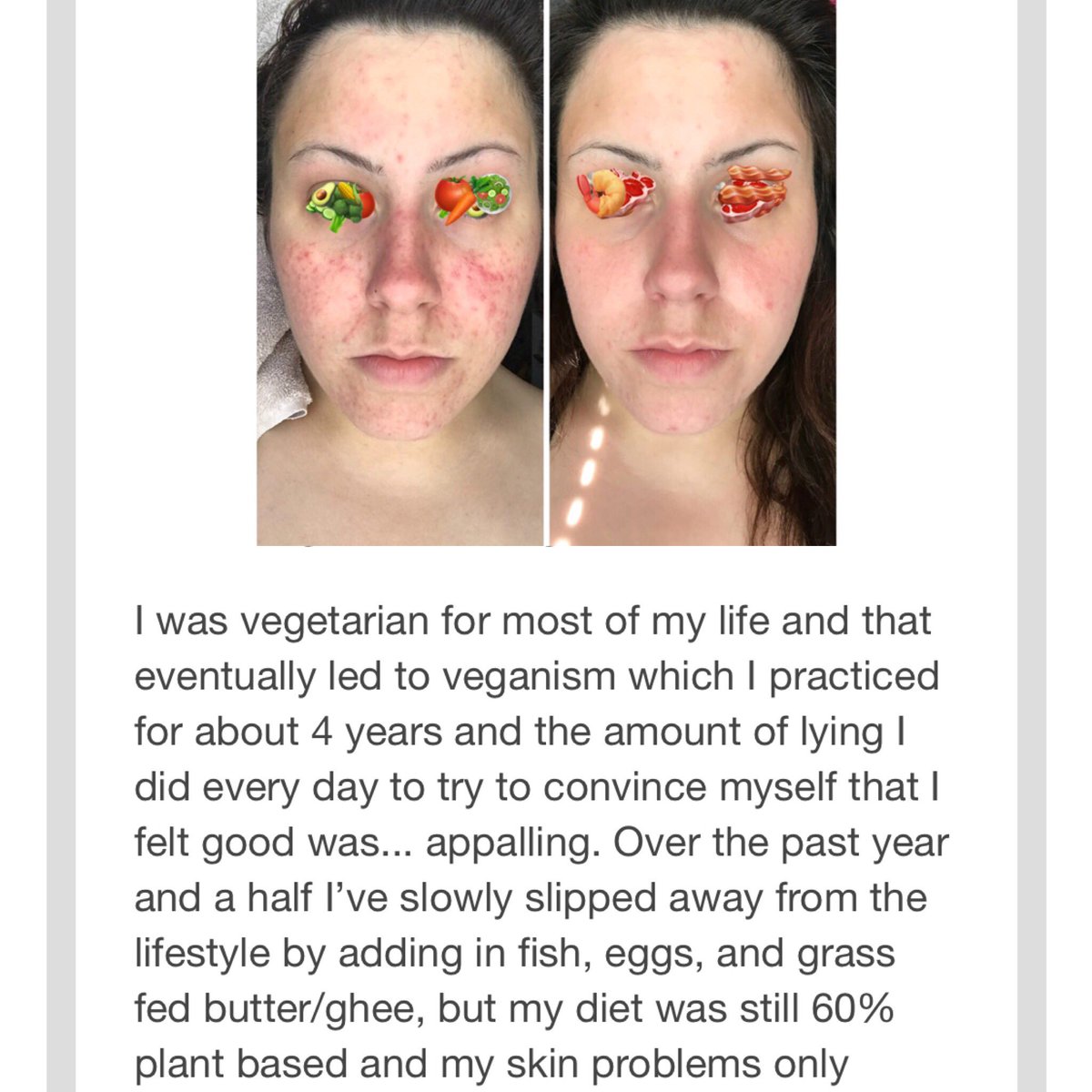 Dr Shawn Baker On Twitter Tired Of Lying To Herself And