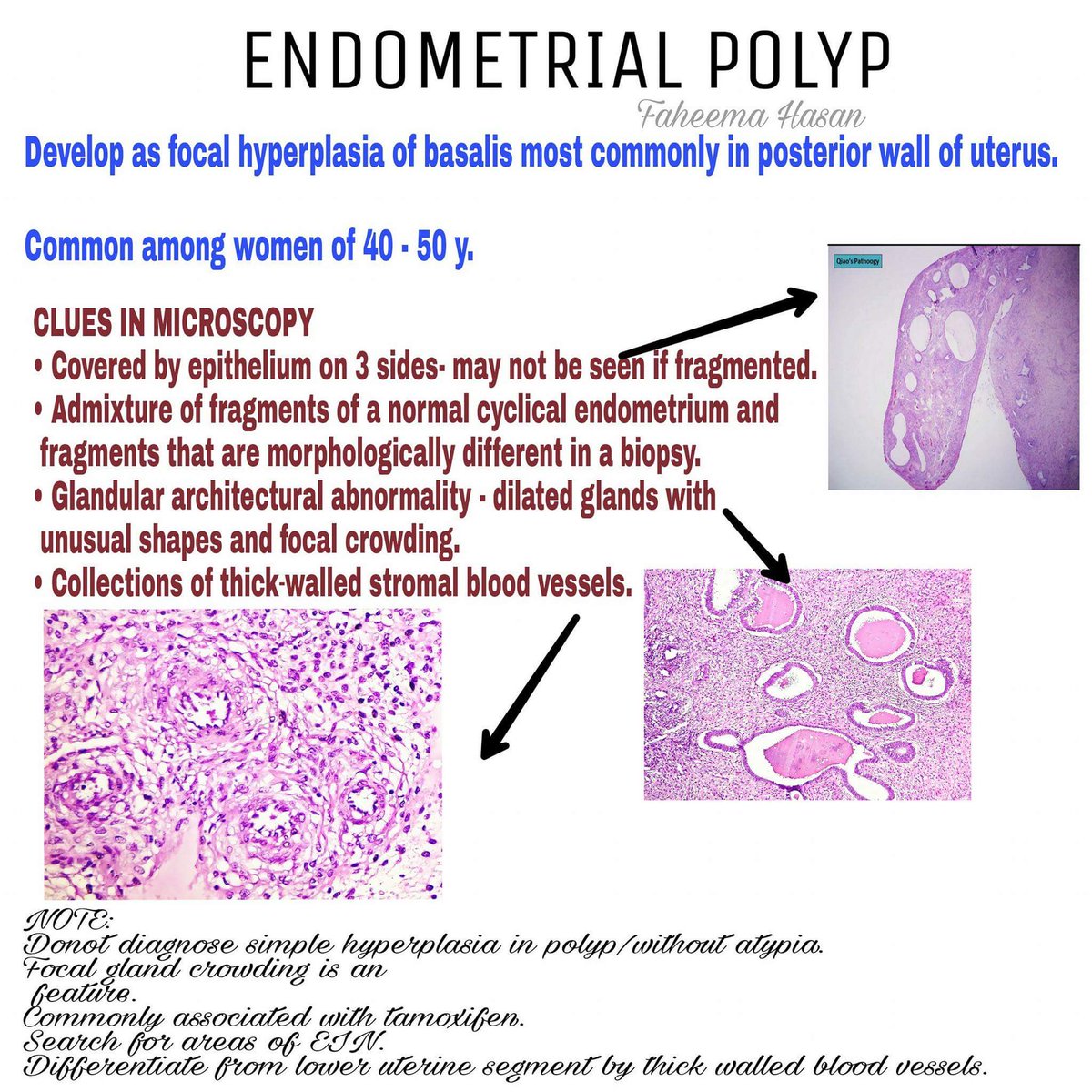 The pathology endometrium of Endometrial pathology