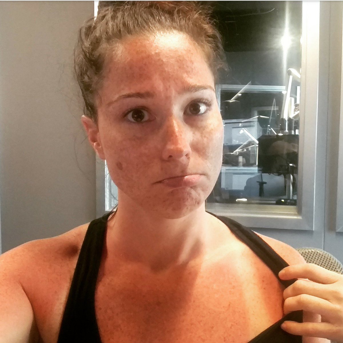 SeattleWolf's tweet photo. Did anyone else get a little too much sun this weekend? #SunScreenFail #NeedSPF #Sunburn #LessonLearned #MWP ~ @MorningWolfEm @MorningWolfMatt https://t.co/RGuIzWMVjN