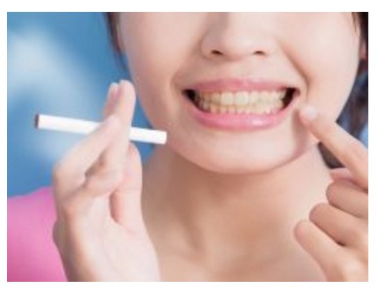 Desde Bucco recomendamos la lectura del Informe “Cesación Tabáquica y Salud Bucal” : El papel del dentista y cómo implantar medidas de deshabituación, publicado recientemente por <a href="/DentistaModerno/">eldentistamoderno</a>: bit.ly/2Knqpn3 #tabaquismo #odontologia #saludbucodental #buccoespana