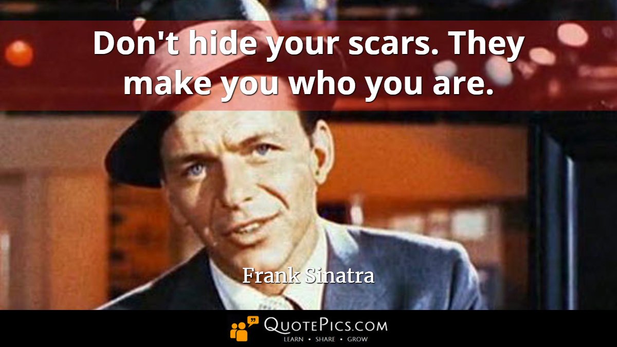 CoolQuotePics's tweet photo. We all have scars, inside and out. They are a testament to our character and inner strength. And we have the marks to prove it. 

As such, "Don't hide your scars. They make you who you are." —Frank Sinatra

#MondayMotivation #MotivationMonday #characterdevelopment #inspiration https://t.co/yFR7Li85Kt