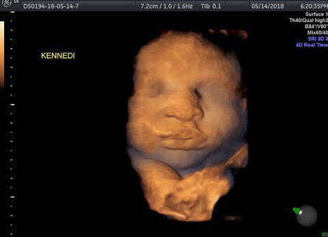 baby_dimensions's tweet photo. #37week #baby in 3-D  at #babydimensions
Amazing what #great hydration does for #qualityimaging  We Sell gift certificates to https://t.co/lG9PGHmiAO