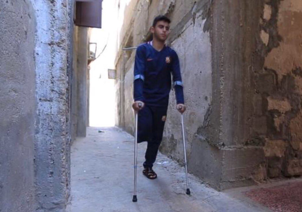 SaveChildrenEs's tweet photo. “Cuando desperté me habían amputado la pierna”. Rashed tiene 16 años y vive en Gaza. Como él, un millar de menores de edad palestinos han resultado heridos por los ataques israelíes de las últimas semanas. Las heridas físicas y psicológicas están siendo de una gravedad extrema. https://t.co/giazVK06wE
