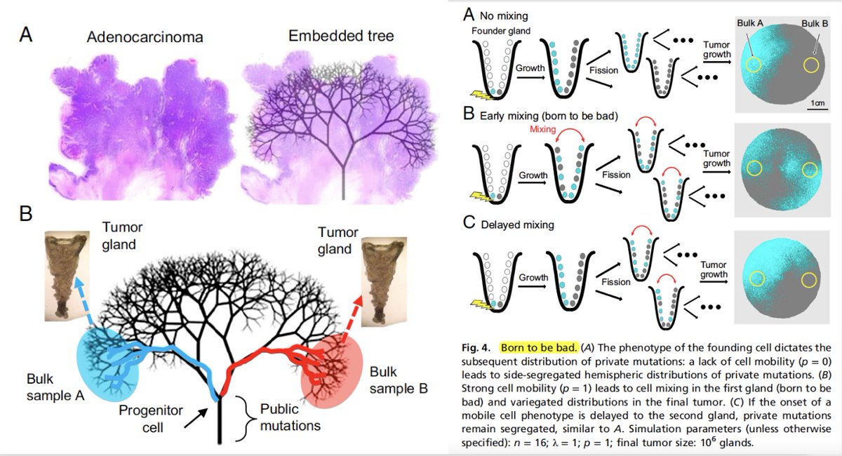 EricTopol's tweet photo. Are certain #cancers "born to be bad"? 
A provocative study of propensity for early metastasis https://t.co/3rhJQZmL7Y @PNASNews by @mdryser et al @DukeHealth @USC https://t.co/NXS7hUlY9T