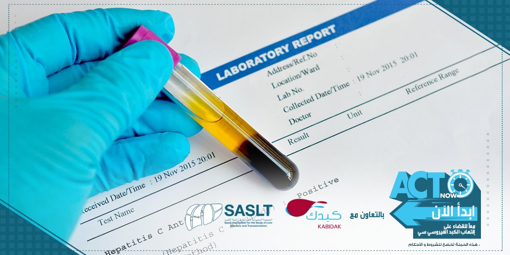 ACTNowKSA's tweet image. الاطمئنان بعمل الفحوصات الدورية هام للغاية لاكتشاف حالات فيروس سي  قبل أن ينشط ويتحول إلى مرض مزمن 
#التهاب_الكبد
#ابدأ_الآن
 @kabidak @sasltksa