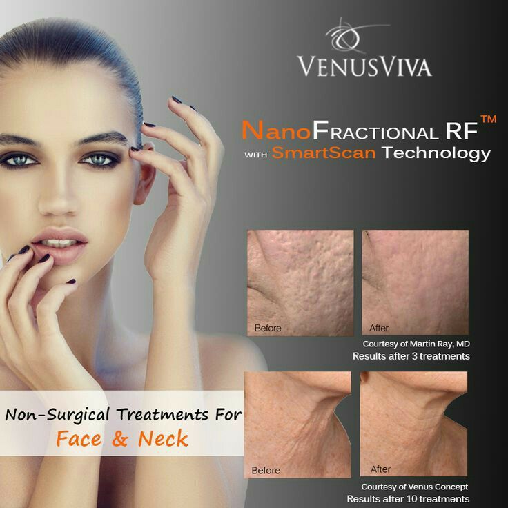 Non-surgical treatments for #face and #neck
#nopain #nosurgery #noinjections #nosideeffects 
No pain but you will surely #Gain a younger looking  skin and a #New you.
#iloveskinsense #skinsense 
buff.ly/2txAomd