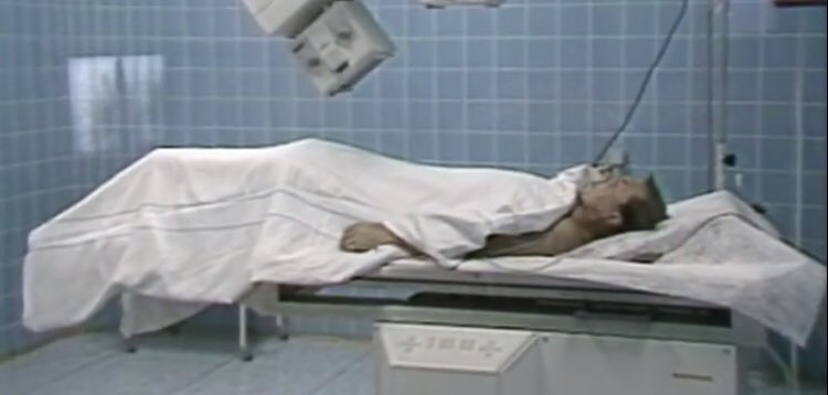 UrologieKarlov's tweet photo. 15.5.1987 byla v tehdejším Československu provedena 1.operace kamenů ledviny RÁZOVOU VLNOU. Kde? No přece na @UrologieKarlov @CUS_CLS_JEP #uroczech #eswl #lerv@ https://t.co/Uola0XKqjq