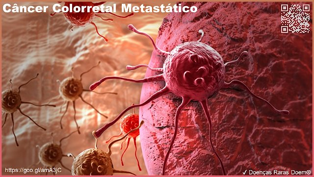 BrazilSFE's tweet photo. Compartilhe! Dê like.
✔ Doenças Raras Doem®

#Carcinoma #Cancro #Cervical #Útero #Colorretal #Câncer #Pele #Endométrio #Interferon #Mama #Melanoma #Metastase #Neoplasia #Oncologia #Ovário #Papanicolau #Papiloma #Peritoneal #Próstata #SUS #Trompas #Tumor https://t.co/YoYQGSH5lE https://t.co/8dAK6Zi7rP