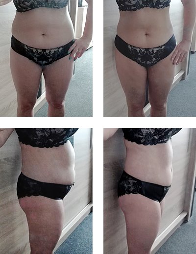 „Ich fühle mich jetzt viel besser“ Monika V. (41), Slowakei.
„Ich ernähre mich gesund und trotzdem hatte ich immer ein Problem mit dem Gewicht. Aber dann habe ich von HYPOXI erfahren und probierte diese Methode im HYPOXI-Studio Magic aus:   
goo.gl/WRAumm