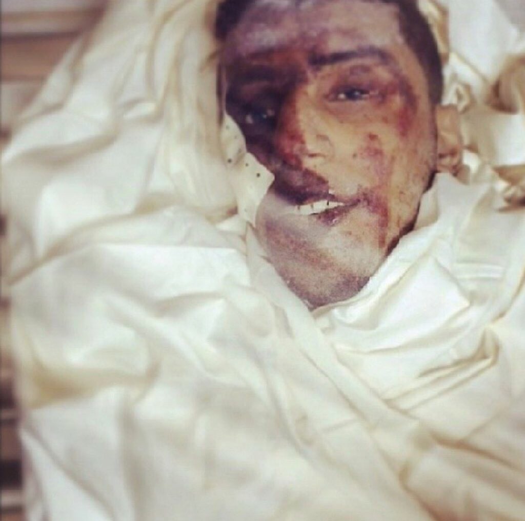 katyushaa_'s tweet photo. يا شهيدَ الحقِّ قُلْ لي كيفَ تَسكُن في السماء، في الضلوع ؟! 

#الشهيد_علي_فيصل https://t.co/JN16LIffNw