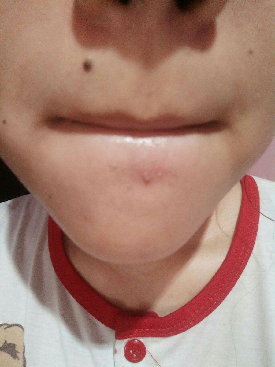 How To Canci Ala Oni K0riya