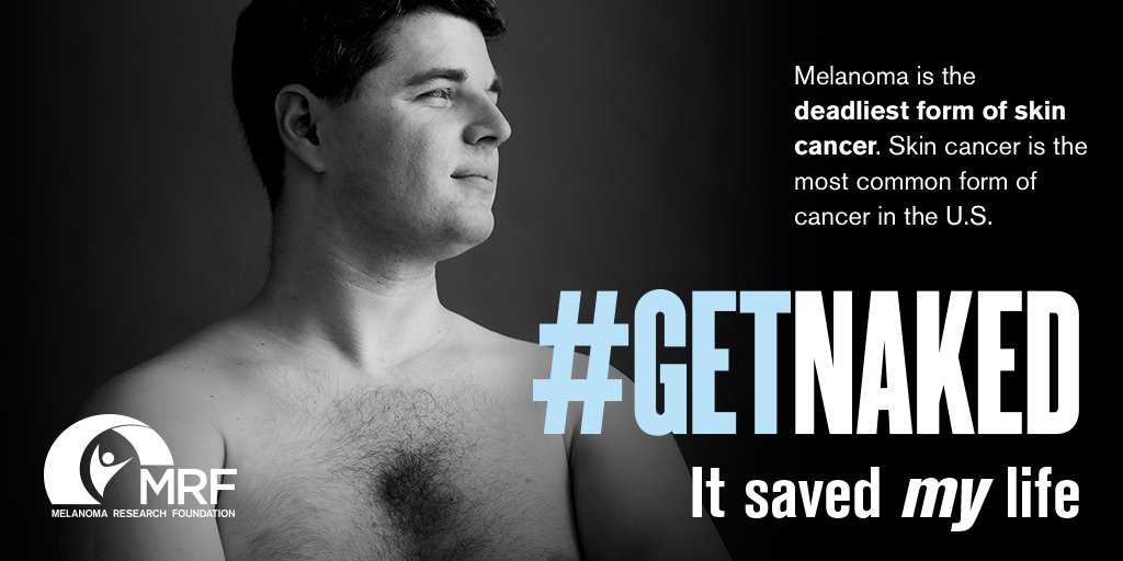 CureMelanoma's tweet photo. "One month before our wedding, I noticed a lump." After a #melanoma diagnosis, Joe and Andrée learned patience, perspective and how to celebrate the "wins" in life. https://t.co/NqooNGwxdD #GetNaked #MelanomaAwarenessMonth https://t.co/UXhgPeXPOb