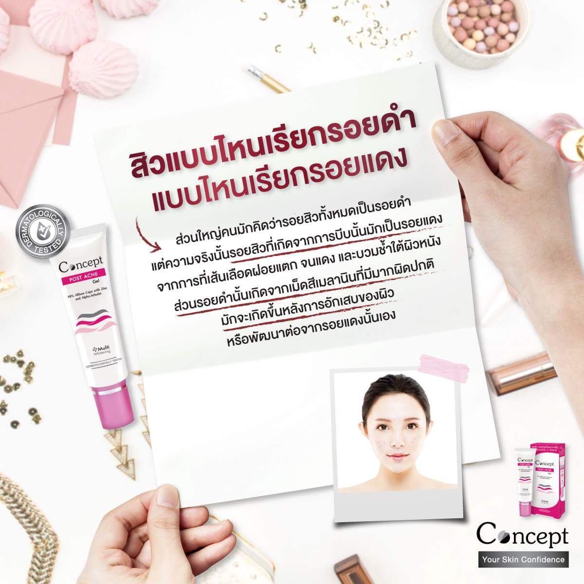 gooon_therapist's tweet photo. 🌻ความรู้ดีๆจาก Concept cream 
🌹Concept post acne รอยแดงสิว 
🌸135 บาท ลทบ 20 Ems 40
#conceptcream #conceptpostacne #HowtoPerfect #howtobeauty #แผลเป็น #แผลเป็นสิว #แผลเป็น https://t.co/tTnjEgAZyR