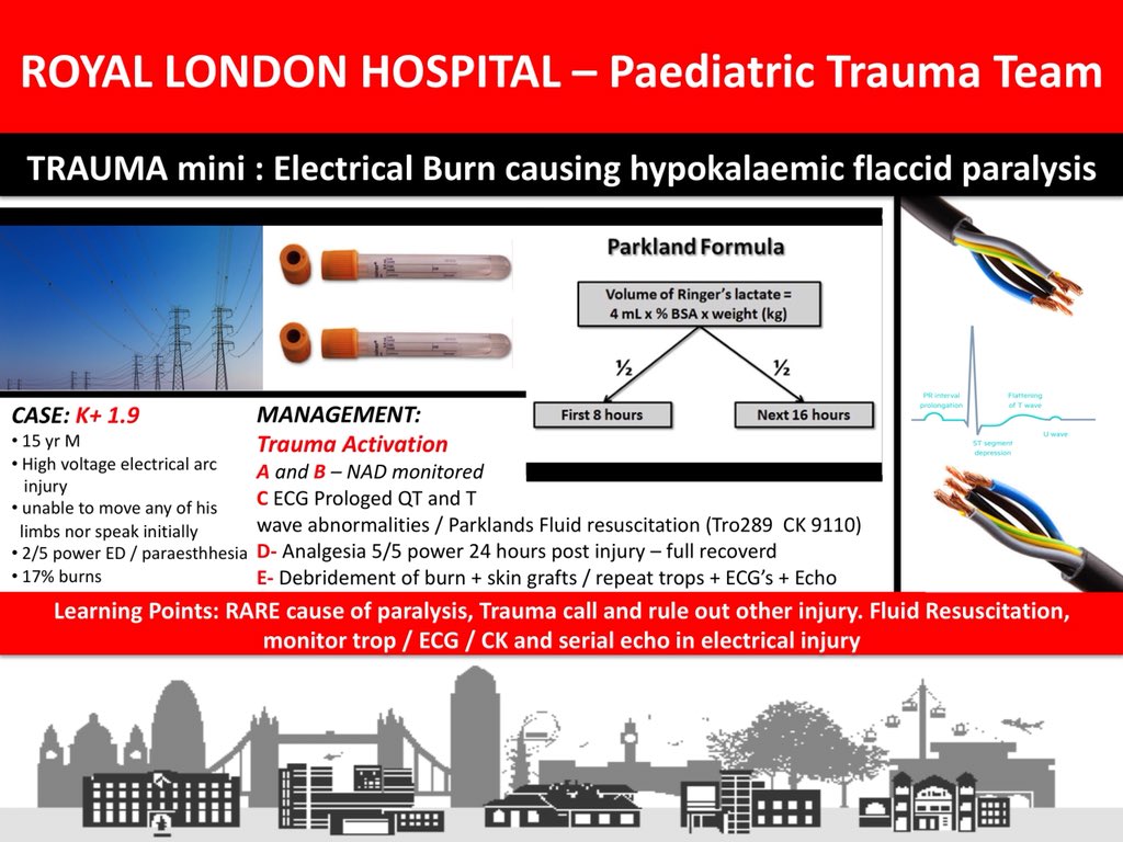 RLHPED's tweet photo. Learning from Trauma #TraumaMini Paediatric Burns (with parental + patient consent)  #Anaesthetist #EM #Anaesthesiology #Trauma #Paediatricmedicine #paediatrics #FOAMed @bredabon @naomi_edmonds @karimbrohi @RLHTraumaTREATS @martinpgriff @AnnielondonAA #learning #Education #burn https://t.co/wygc8AndGb