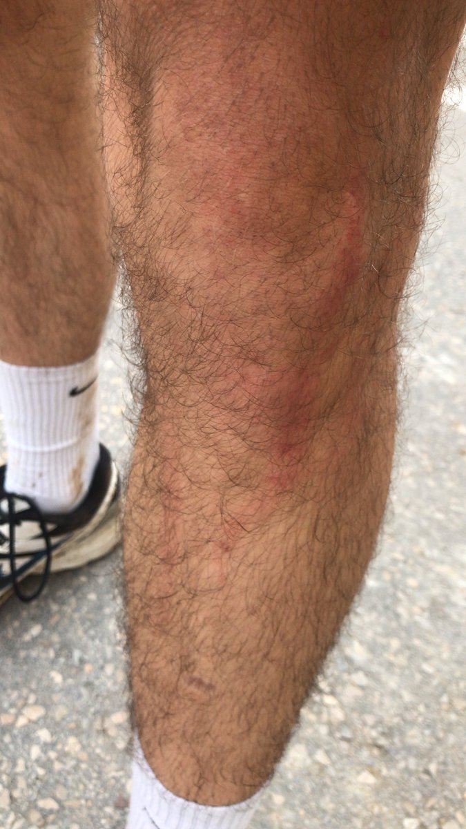 albertdmcat's tweet photo. El perill de les trampes per ciclistes. Sobretot quan surts a córrer. Filferros a mitja cama.
I també m’he trobat claus al terra (que per sort, no he trepitjat).

A la muntanya pelada a #Olot, en sentit la Pinya.
COMPTE! https://t.co/ddycSTdwf9