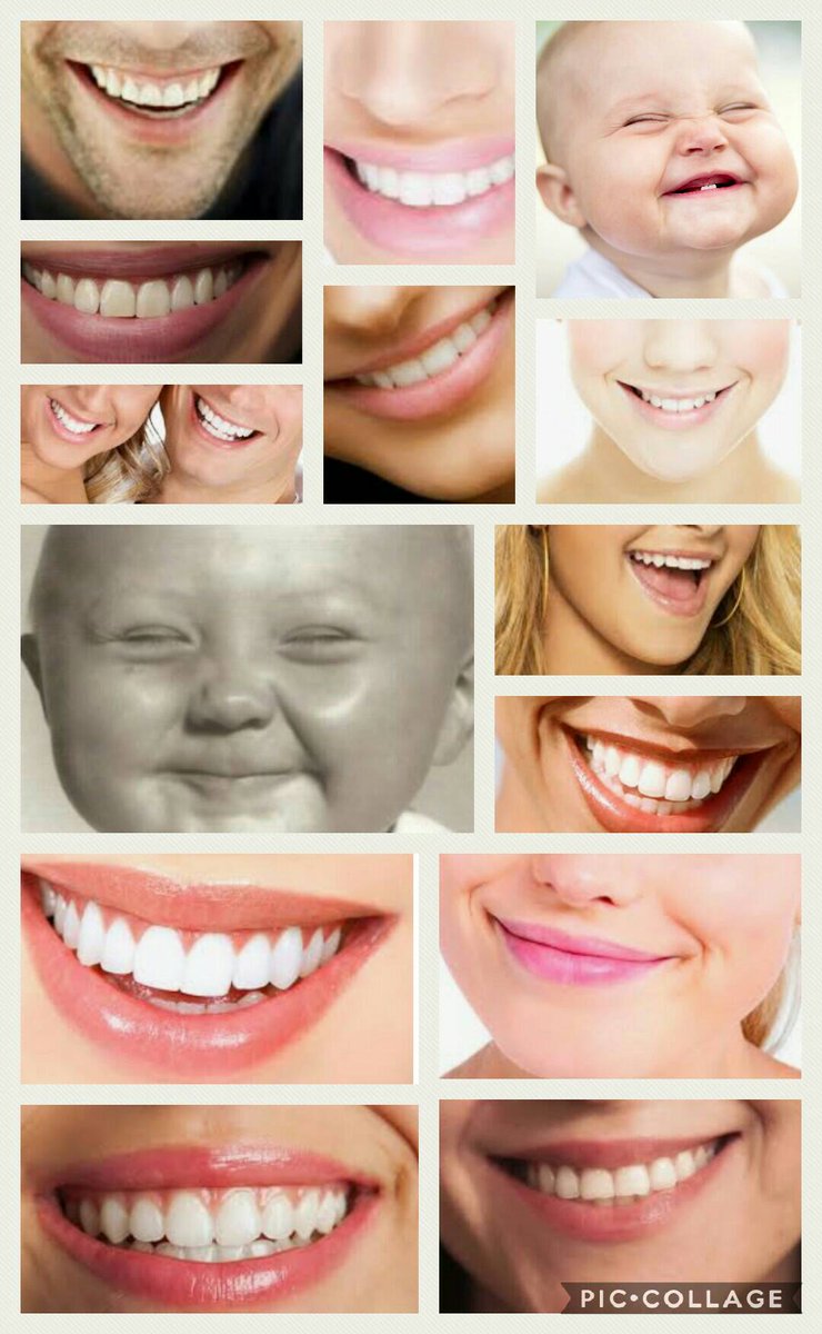 Hughesandowen's tweet photo. TODAY'S FACT!! Smiling is infectious! Help start an epidemic today 😊#SmileMonth #dentist #burtonontrent #Swadlincote https://t.co/0MLTSFzruh
