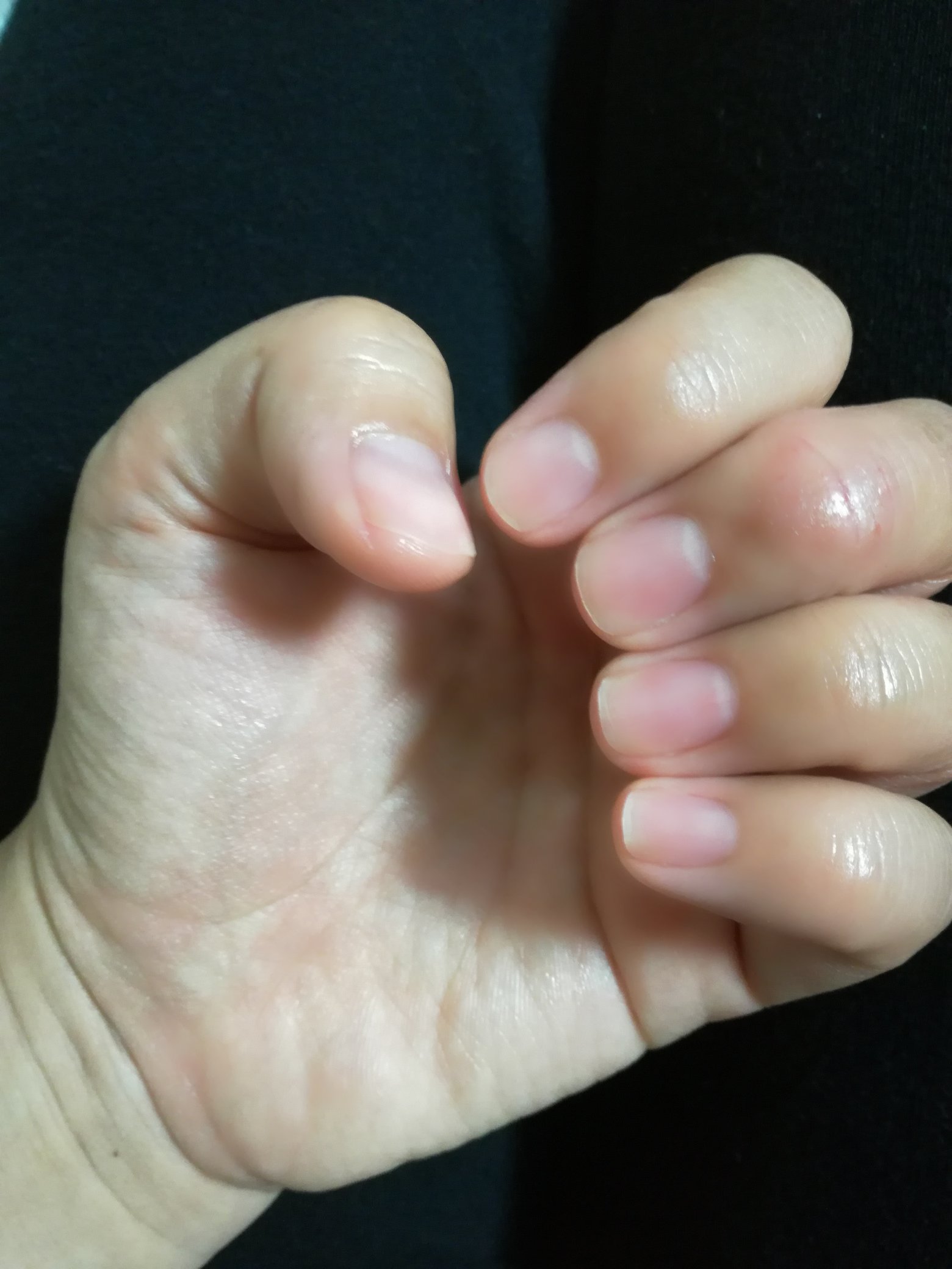 Kinoko 爪が欠けてしまったので 思いきって全部の爪を短くしました ネイルもお休みー ショートネイルなのが悩み 爪キレイな人うらやましい ﾟaﾟ ショートネイル 素爪 T Co Vb3dswra25 Twitter
