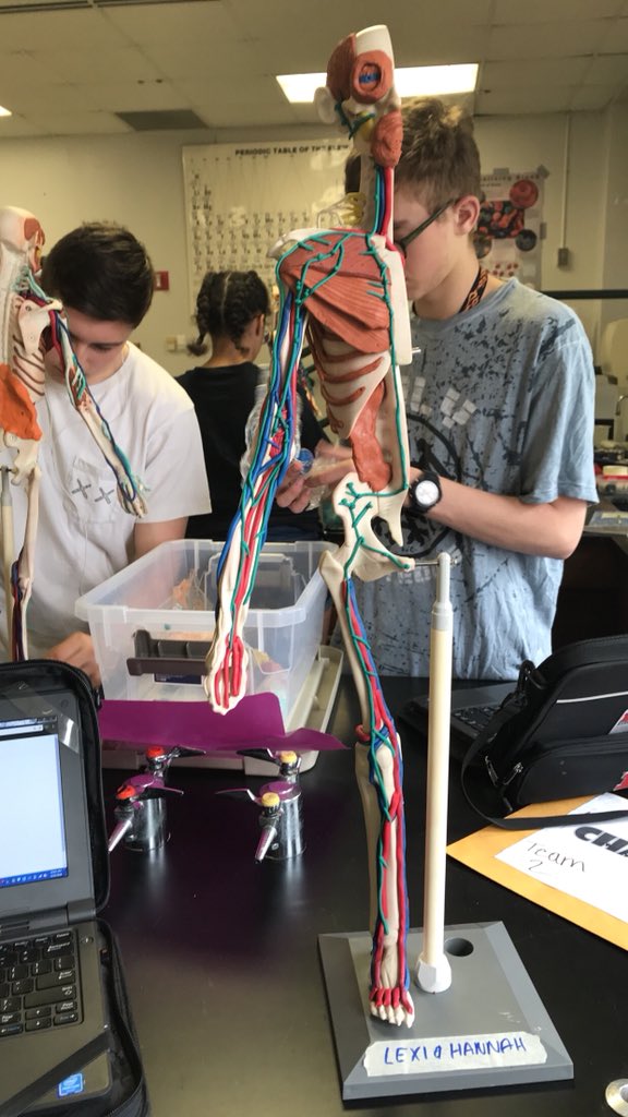 02Trotter's tweet photo. Lymph nodes filter through fluid and blood searching for disease or any type of illness. They also become inflamed when they detect an illness. @lexi_mills33 #RHSBMS https://t.co/7nnUfKYFLA