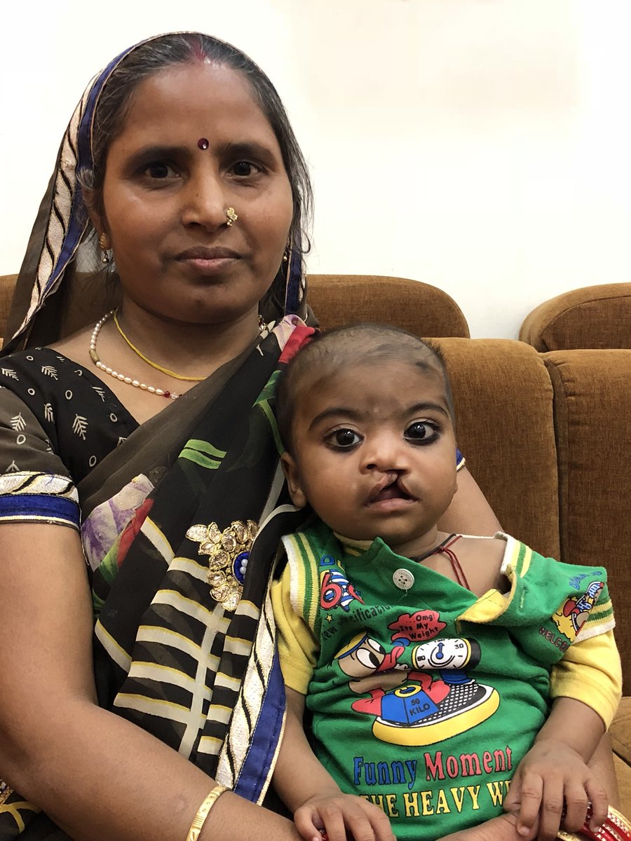 This Child was left near a river by his parents when they found that he had Cleft Lip. He was found lying there, ants covering his body by husband of this lady. This Couple already had 7 kids (4 boys & 3 Girls), but adopted Him with Open Heart. His Free Surgery is scheduled (1/2)