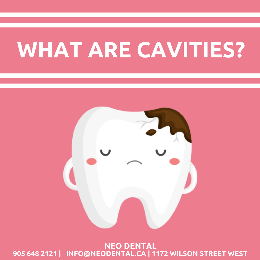 What are cavities? Check out our newest blog post on our website to learn more. buff.ly/2L1xfzB #NeoDental #RefreshinglyDifferentDentistry #EatingWell #BlogPost #NeoDentalBlog #OralHealth #OralHygiene #Ancaster #Dundas #Hamilton #Ontario