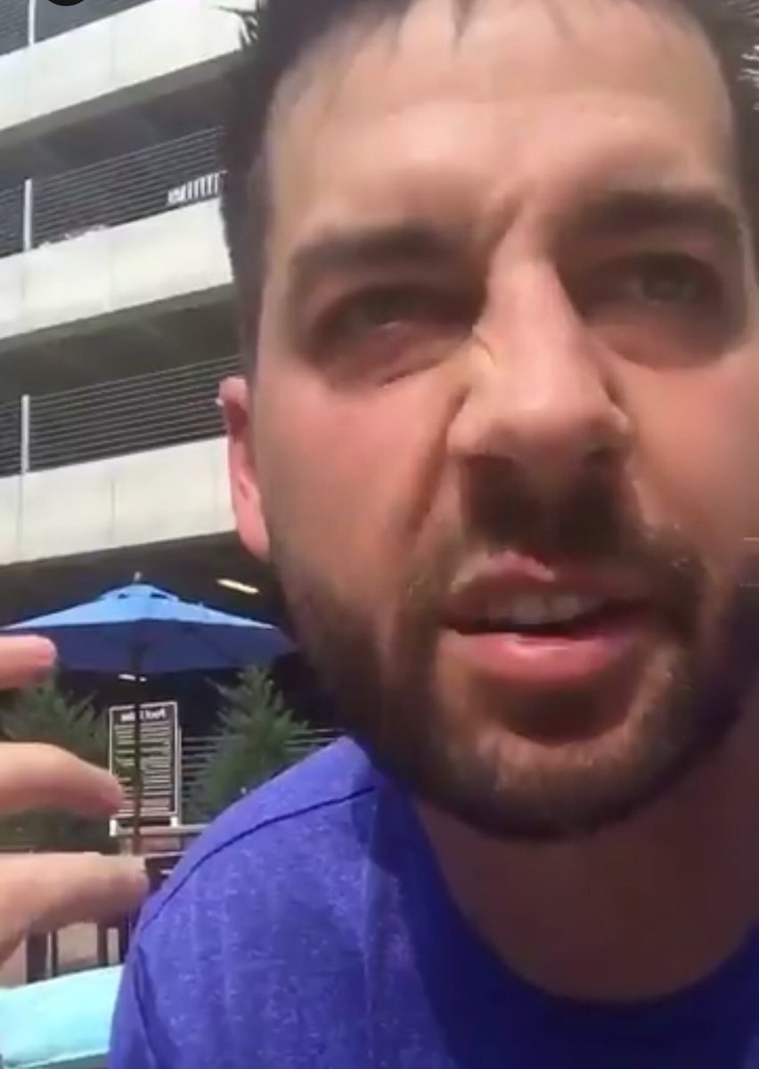 johnbcristt's tweet photo. Am I the only one that notices @johnbcrist twitches his nose a lot?
😂😂 #okimslightlycritical https://t.co/rZfUMxVQs8