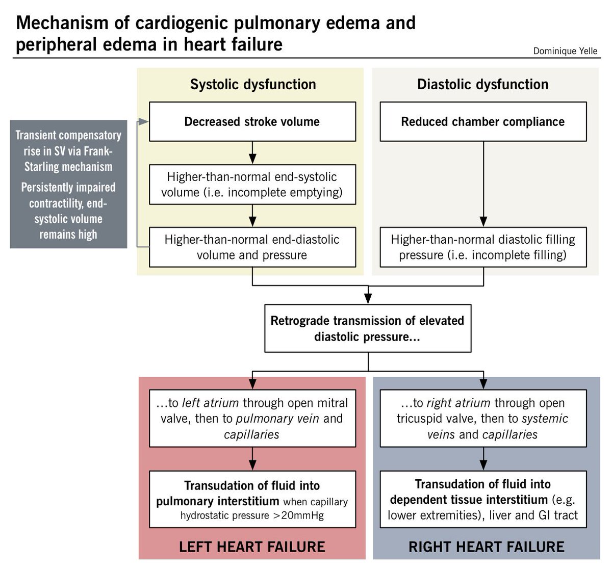 From Heart Failure Pulmonary Edema