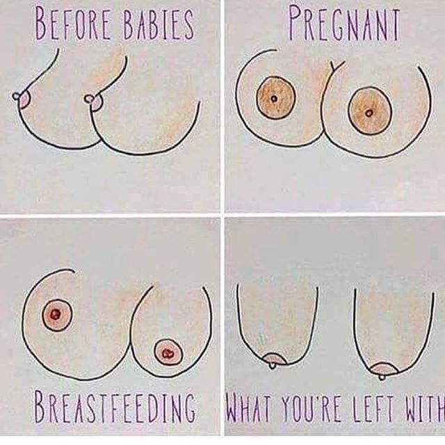 Don’t have kids if you want to keep your perky tits! #birthcontrol #itsanoption #boobs #pregnant #lol #memes #followforfollow #tagafriend #comment #share #retweet #justdoit ift.tt/2ImDY9T
