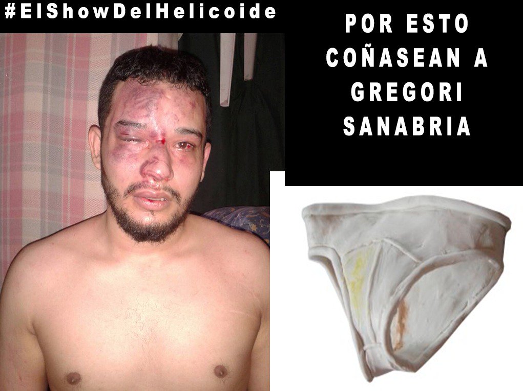eflorencia147's tweet photo. El Helicoide tremenda paliza le dieron a Gregori Sanabria y anda pisdiendo DDHH  #PresosPoliticosTerroristas 
Josh Holt Terroristas https://t.co/jvjXgZNZE8