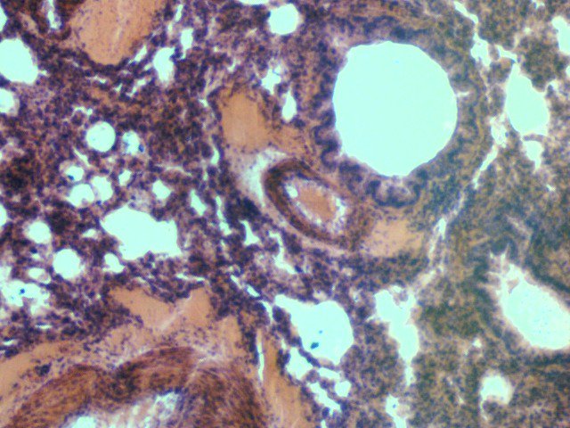viverwiz's tweet photo. Human Lung section, 40x magnification by light #microscopy. Stay clear of smoking and pollution to keep yours pristine! #human #physiology #medicine #discover #science #explore #nature https://t.co/G61HmWpjGO