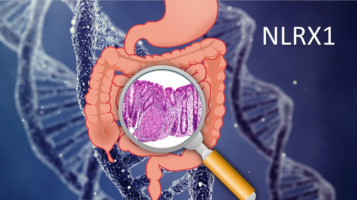 NIMMLab's tweet photo. @NIMMLab identifies #NLRX1 as a possible therapeutic target w/ experiemental and #ComputationModels -> #IBD #Chrons @J_Immunol 
https://t.co/N2ucxLEqqr https://t.co/b9kHY4XzH6