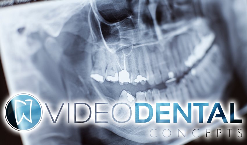 VideoDentalConc's tweet photo. Check out these 5 benefits of the MobileX handheld dental x-ray machine! #HandheldDentalXRayMachine #HandheldXRayMachine #DentalDigitalImaging #DigitalDentalRadiography #handheldxraycamera #digitalradiography #xraygenerator #dentalimaging #VideoDental https://t.co/jfGDQlxvzi https://t.co/01ZOD9BenO