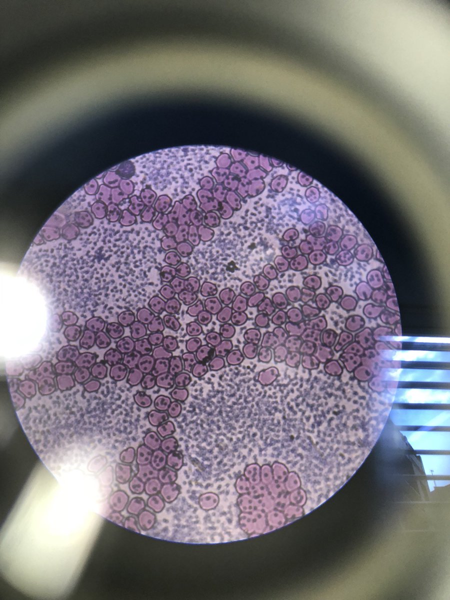 MagiclabTfn's tweet photo. Hoy hemos seguido con nuestras prácticas de laboratorio 🔬 después de las tinciones del otro día hoy hemos podido ver las plaquetas en el microscopio en algunas imágenes no se puede ver presencia de plaquetas. Esperamos que os gusten las imágenes.@jesuitesFP #LAB1719 #LaNovaFP https://t.co/COruZlVej1