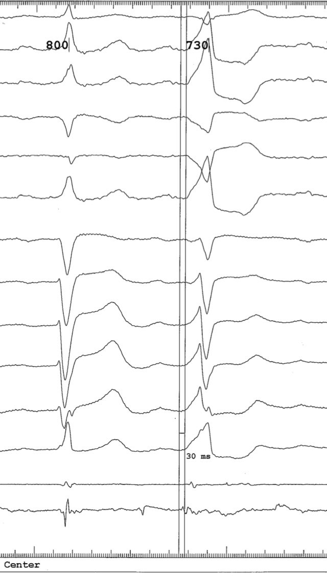 Kanwar Y. Singh tweet media