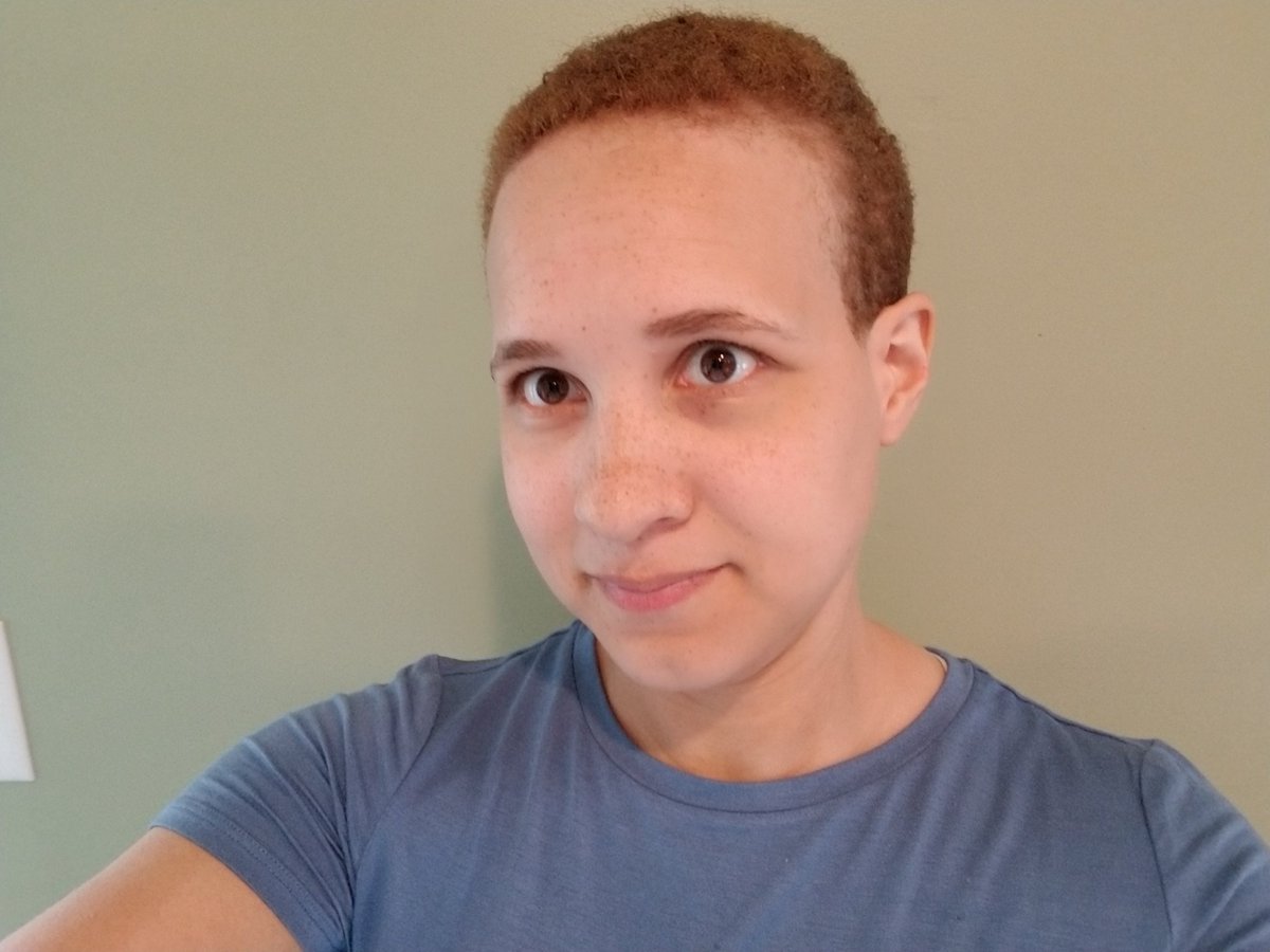 NFibro's tweet photo. Did the #bigchop and I am starting over with super short hair. Mainly b/c my hair was unhealthy, but also because I have #eczema all over my scalp and it's easier to deal with it with short hair. If you have the same thing, what has helped you? https://t.co/NcZb5Lg93z