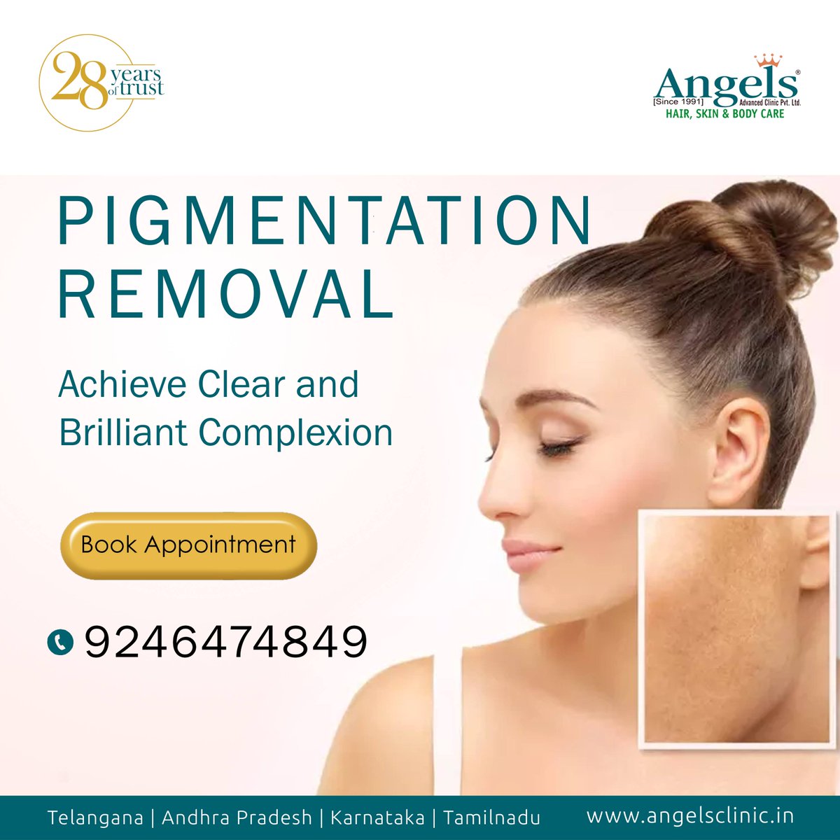 Angels Clinic On Twitter Healthier Clear And Fairer Complexion