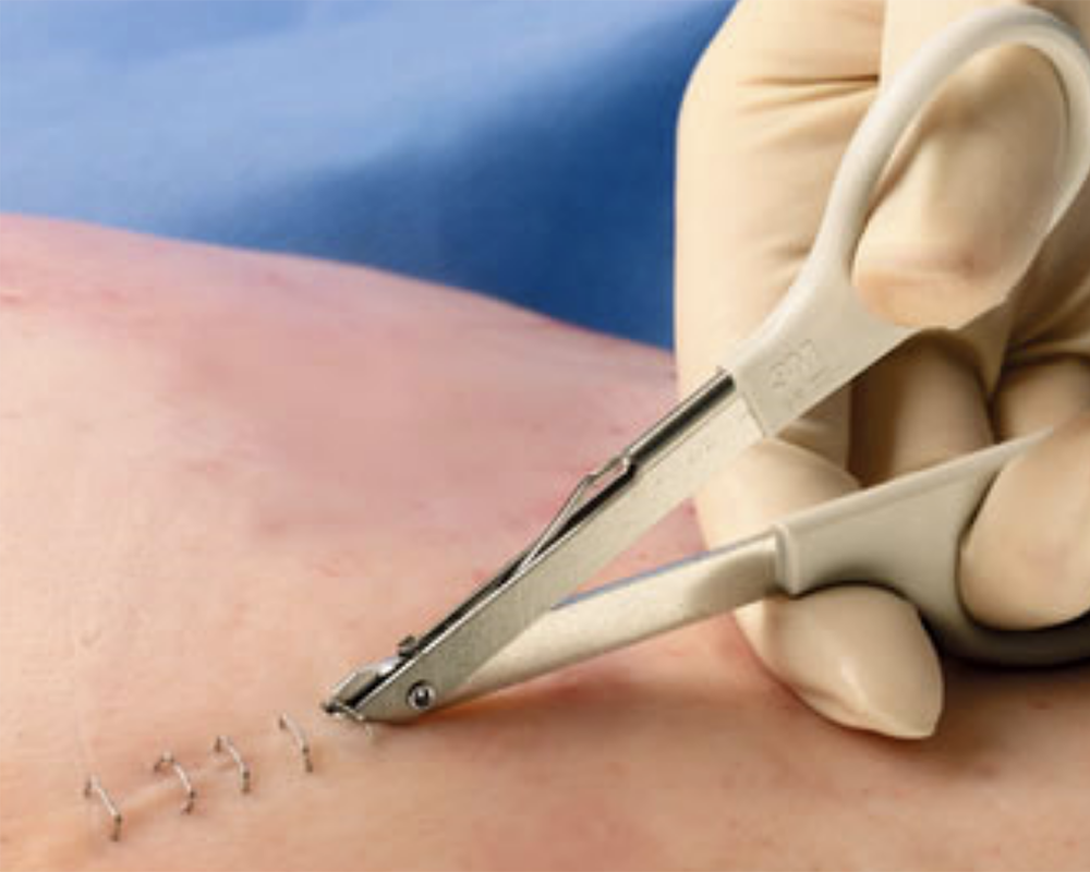 ProviderPrep's tweet photo. #Surgical staples are most often used for repairing #wounds in the skin and having the right instrument is extremely important for removal when considering comfort and convenience. A few aspects to consider when it comes to proper staple removal: 

https://t.co/PWfiMsrovc https://t.co/HjV5CCqFJ5