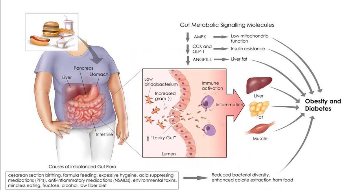 CrazyTech13's tweet photo. Ketogenic Diet, Endotoxin &amp; Gut Health
https://t.co/rGF2nDzoe7 https://t.co/WDmG0IYMhK