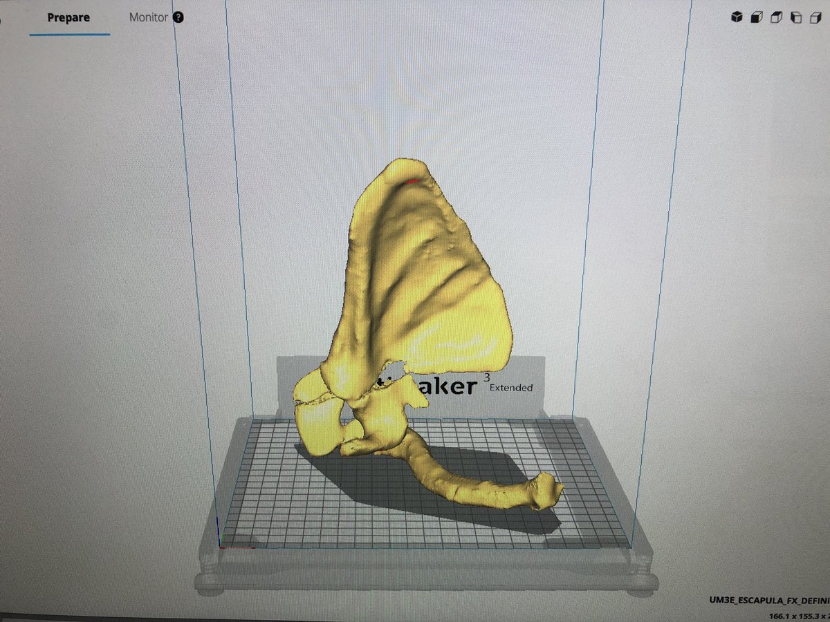 miguelgm_1's tweet photo. 3D print of a fractured scapula for surgical planning and educational purposes at @3d_maranon. @rupermac @calvoharo_ja @3DGabBME @CharlieMonitor @d_andrea3 #HospitalMarañon3D https://t.co/Nxt6fq5iNq