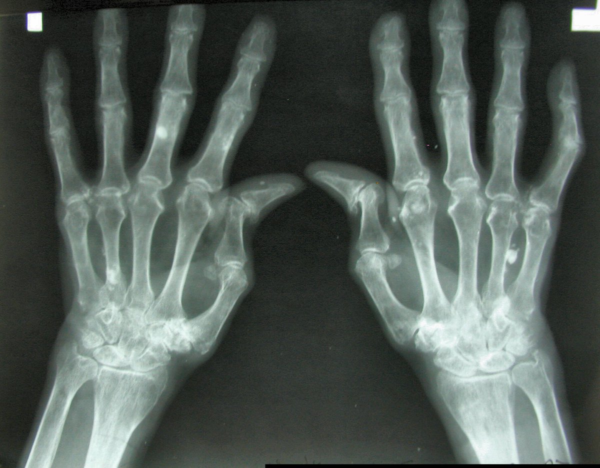 NRAFamily's tweet photo. 7 #Handgun Tips For People With #Arthritis: https://t.co/a4RADOC2w9 - #Pistols #Guns #AdaptiveSolutions https://t.co/DsacS9INNP