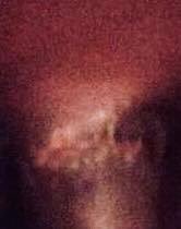 reseaucitadelle's tweet photo. This kid received bad medical practice from US missionaries. They call what you see circoncision. They cut at the bottom of the organ instead of the prepuce. The boy is suffering and needs emergency help.  
https://t.co/QgR8wrP4LE
@AaronTraegerMD @eastviewchurch @AdvocateKids https://t.co/TjTEyTU0ZV
