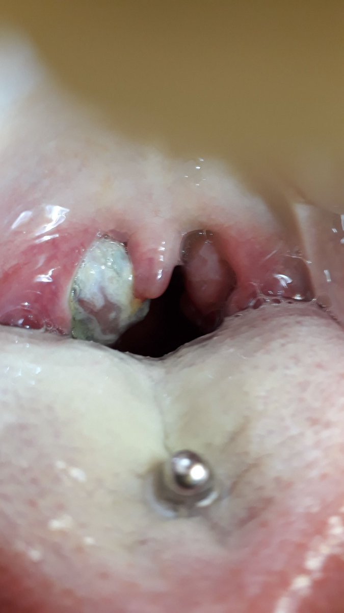 RT O TE VA A SALIR UNO ASI COMO A MI