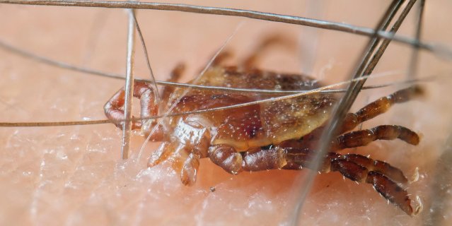 mrsrich95's tweet photo. Yikes! Ticks are not fun https://t.co/lQau0OA3M3 https://t.co/3HIPU27s97