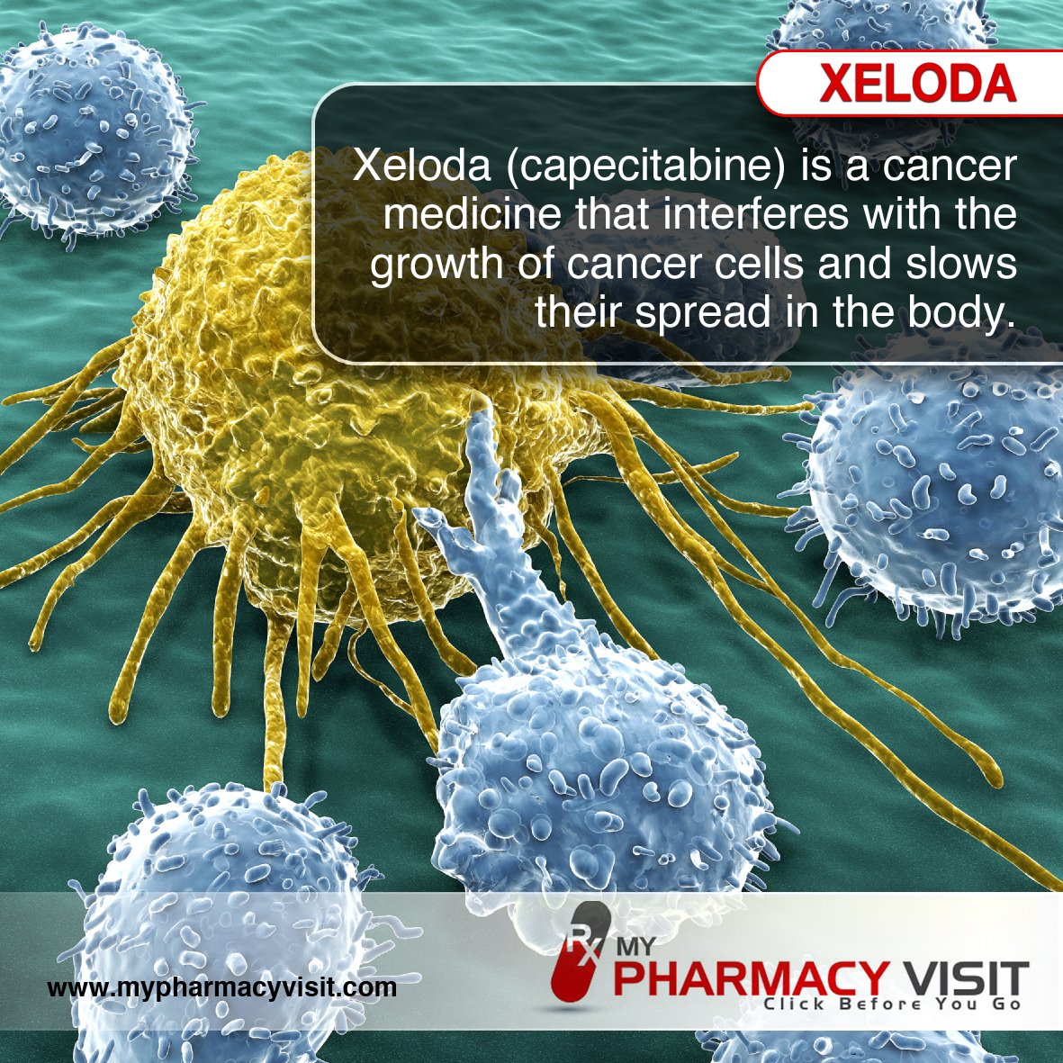 MyPharmacyVisit's tweet image. Xeloda (Capecitabine) chemotherapy side effects, how it's given, how it works, precautions and self care tips for treatment of multiple cancers.
#Xeloda #Capecitabine #sideffects #precauations #treatment #cancers