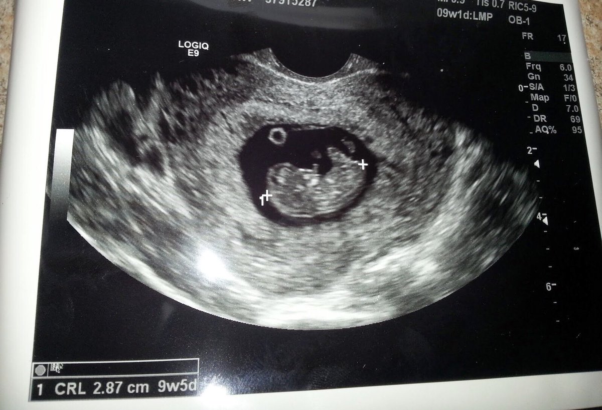 . | H (@1800bree) on Twitter photo 