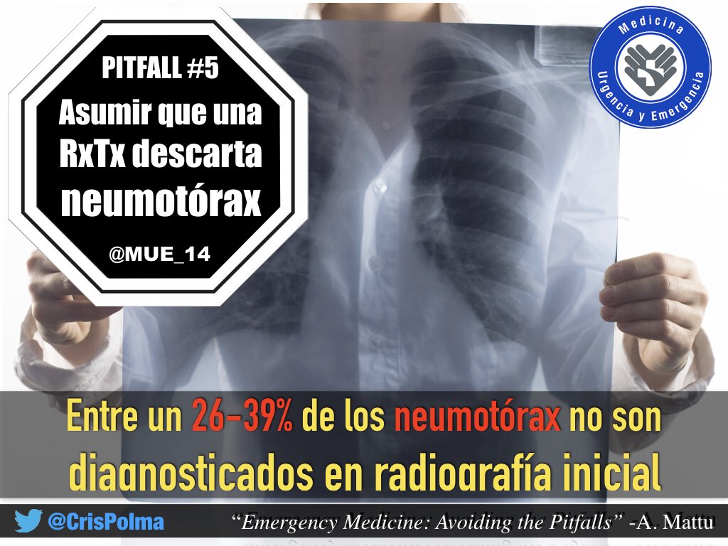 CrisPolma's tweet photo. |EMPitfall#5|
-Asumir que la radiografía de tórax descarta neumotórax.
►KeyConcept: La sensibilidad de la Rx de tórax no permite descartar un neumotorax en el paciente con sospecha clínica significativa.
#FOAMed #MUEUSS #ChileEM #EmergencyMedicine #EMpitfall @amalmattu https://t.co/EcmwaoOSXZ