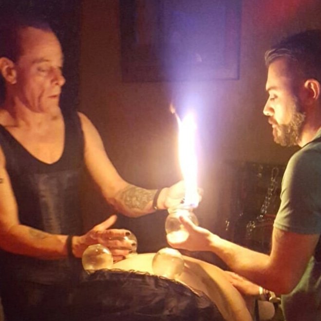 MisterpeterPain's tweet photo. I love couples sessions.  #bdsm #cupping #fire #Entertainment #fetish #firecupping #retweet #RetweeetPlease #follo4follo #addme @RT_com @rtslut101 https://t.co/o5ZZCIpQ9Q